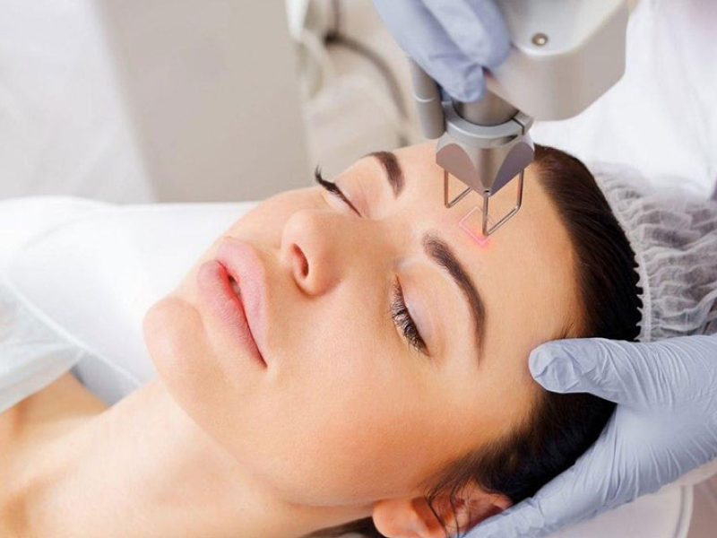 Лазерне омолодження