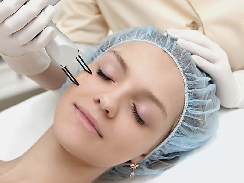 Естетичне лазерне шліфування