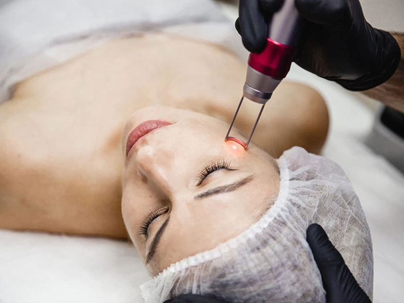 Фракційне шліфування