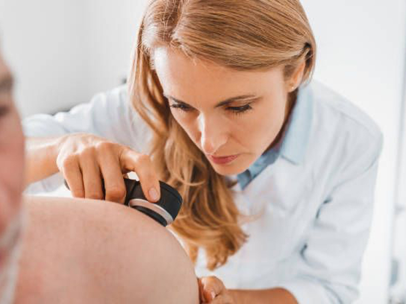 Видалення бородавок