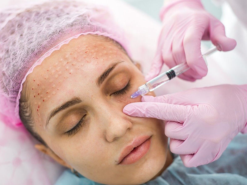 Колагеностимуляція