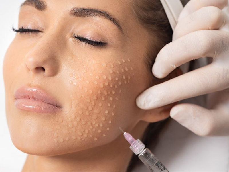 Біоревіталізація