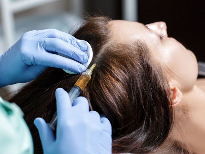 Мезотерапія