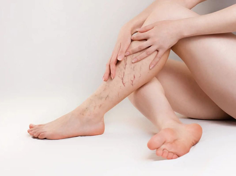 Судинна терапія