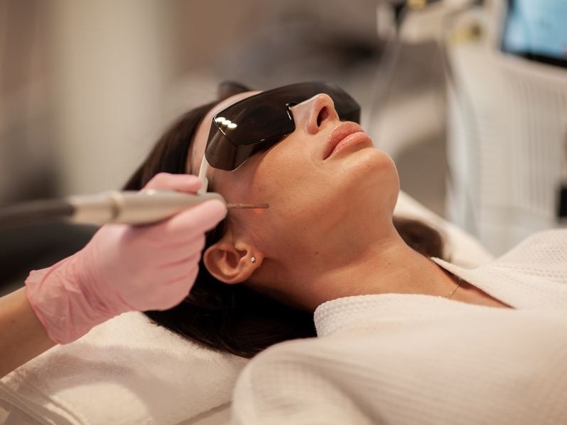 Лазерний гарячий пілінг Лас-Вегас